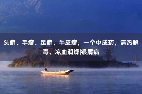 头癣、手癣、足癣、牛皮癣，一个中成药，清热解毒、凉血润燥|银屑病